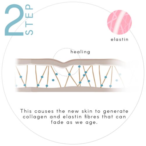 48-plasma-eksaxnosi-skinreal